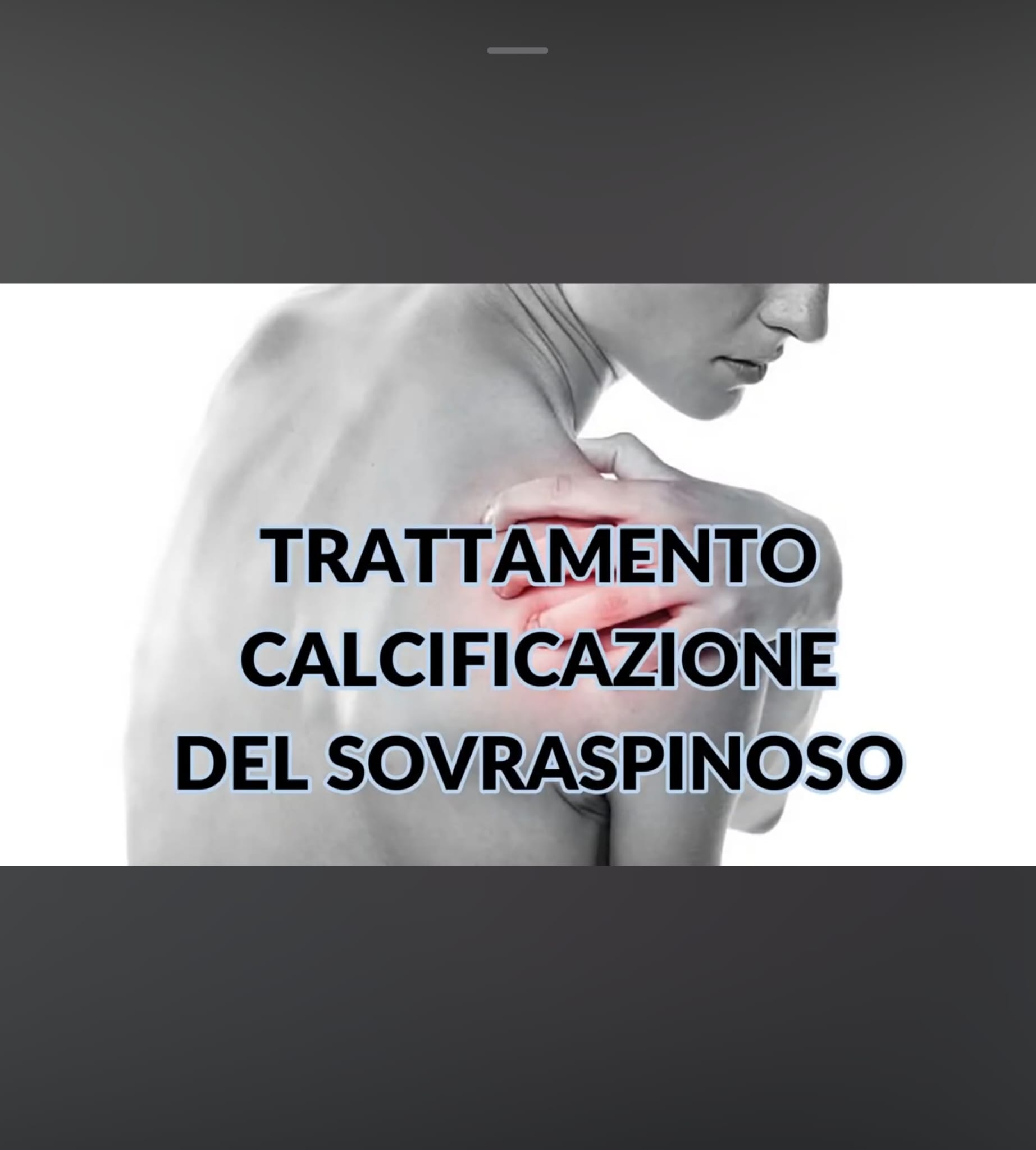 Dettaglio Manipolo