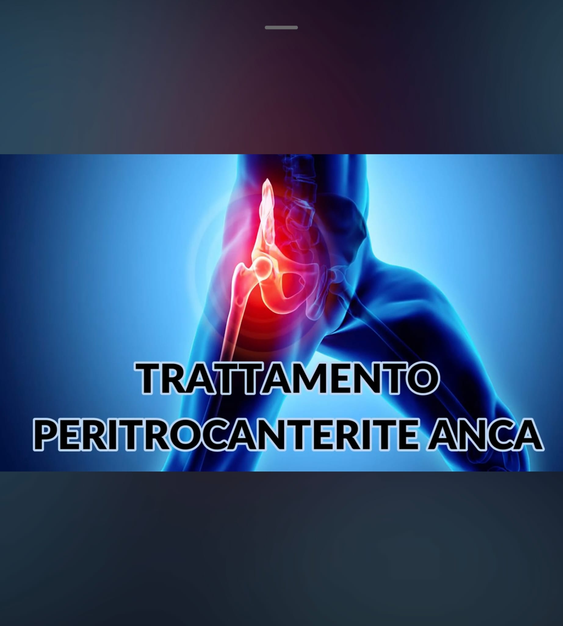 Schermata Impostazioni