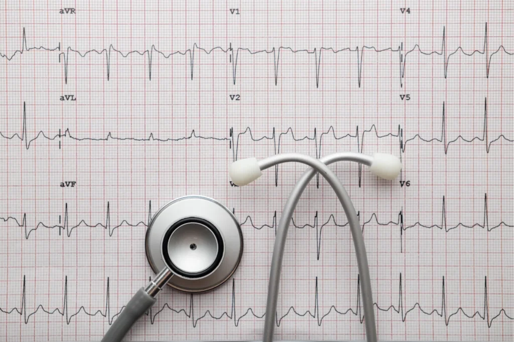 Tracciato elettrocardiografico con uno stetoscopio appoggiato sopra