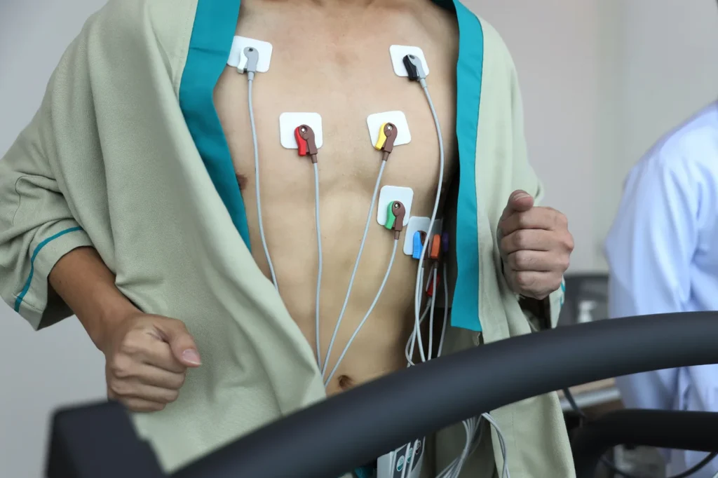 Elettrocardiogramma sotto sforzo durante una visita medico sportiva