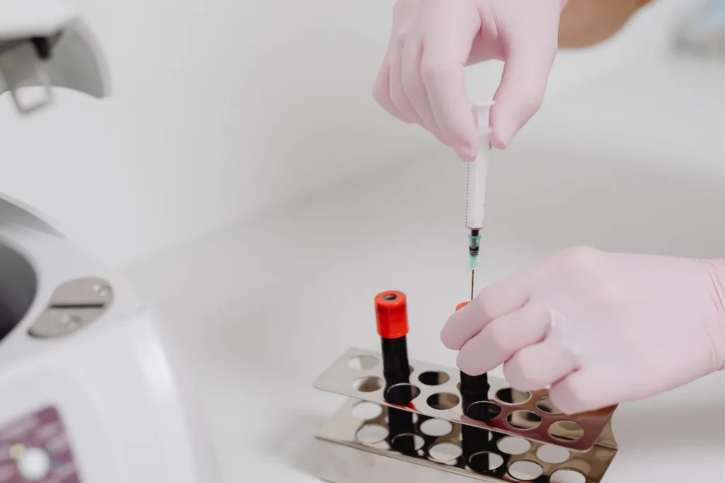Tecnico di laboratorio che pipetta un campione di sangue