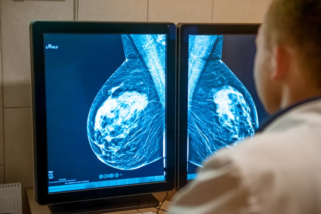 Specialista che esamina una mammografia sui monitor